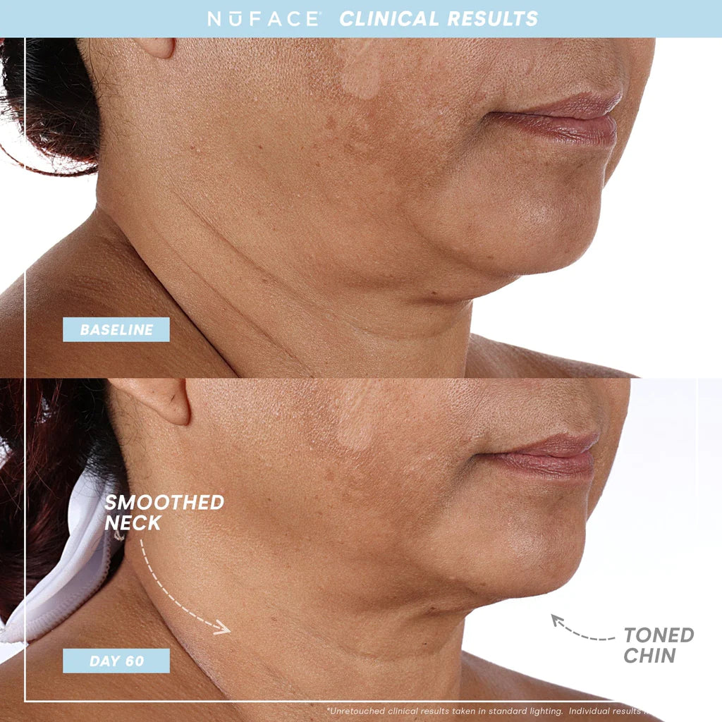 Nuface TRINITY+ Pro Smart Device Facial Toning Kit