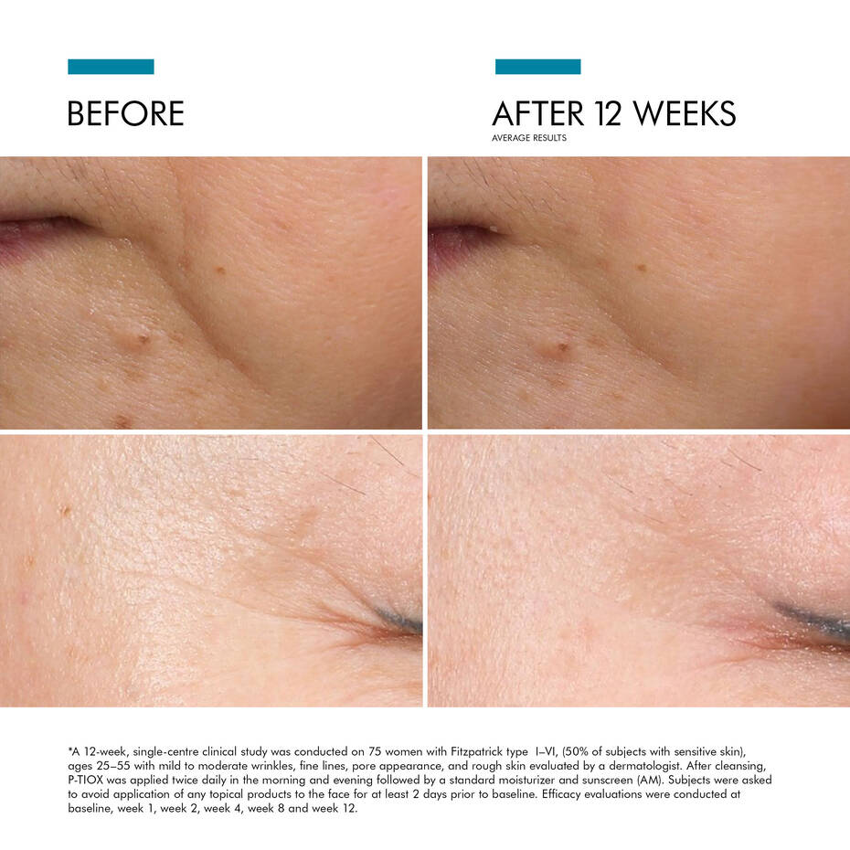 Skinceuticals P-Tiox Serum