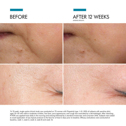 Skinceuticals P-Tiox Serum